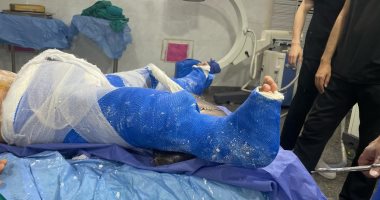 فريق طبى بمستشفى الأطفال بجامعة أسيوط ينجح فى علاج طفل من تشوهات نادرة ومعقدة