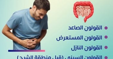 كيف يصاب المرضى بسرطان القولون.. وزارة الصحة تجيب سرطان القولون