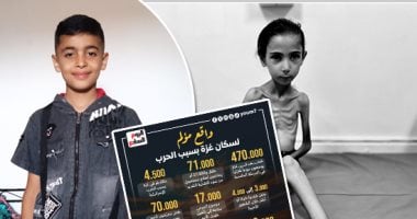 صرخات أمام عيون وقحة (1).. إيهاب فى غيبوبة بعد قصف الاحتلال منزله.. آمال البيوك وزنها لا يتجاوز 10 كيلوجرامات.. ركان العواودة يفقد عينه بسبب علبة تونة مفخخة.. وكرم قديح يفقد حلمه في لعب كرة القدم.. صور جرائم الاحتلال في غزة