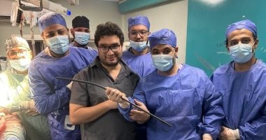 أطباء مستشفى أسوان الجامعى ينقذون مريضًا بعد اختراق سيخ حديدى لظهره وكليته الفريق الطبى