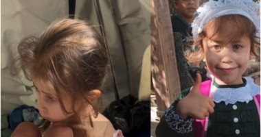 أنقذوا "جنى عياد" قبل أن تلحق بشقيقتها.. طفلة بغزة تصرخ من مرض نادر 