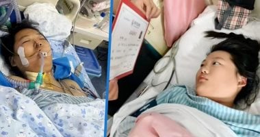 الفتاة فى الغيبوبة وبعد الافاقة 