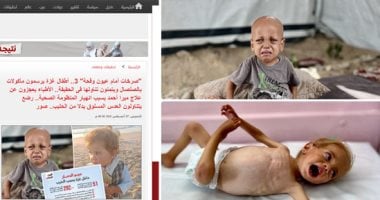 بعد نشر "اليوم السابع" قصصهم.. أطفال بغزة يسافرون مع ذويهم للعلاج بالخارج أطفال غزة