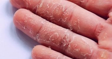 نيوز برو : 
                                            وصفات طبيعية لعلاج تقشر اليدين.. خليهم زى الحرير وأنعم كمان
                                        
