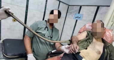 السيخ الحديدي قبل نزعه من ذراع المريض