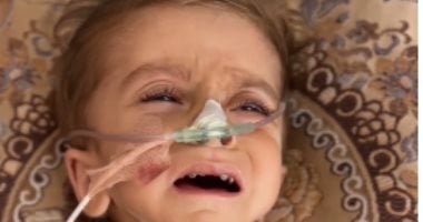 كريم معمر.. سوء التغذية يتسبب في تضخم بالكبد ولا أدوية بمستشفيات غزة الطفل كريم معمر