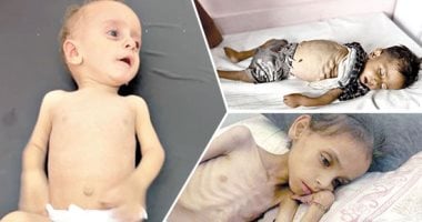 غزة بين الجوع والنار..أجساد منهكة وعظام بارزة.. شهادات من داخل القطاع توثق الكارثة.. عدى ومحمد شقيقان يفارقان الحياة بسبب المجاعة.. فادي النجار مات بعد فقد 50% من وزنه..أم تعرض ألعاب أطفالها للبيع مقابل الدقيق الوضع في غزة
