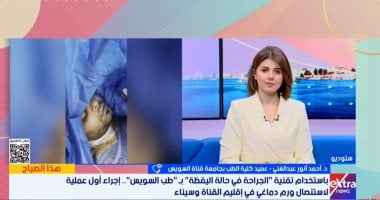 عميد طب قناة السويس يكشف تفاصيل أول استئصال لِوَرَم دماغى والمريض واعٍ.. فيديو