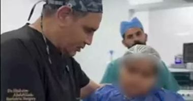 تكميم معدة طفلة يشعل السوشيال ميديا.. القصة الكاملة.. فيديو تكميم معدة طفلة