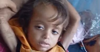 العدوان على غزة يهدد حياة الطفل خليل أبو شعيرة.. وأمه تصرخ لإنقاذه