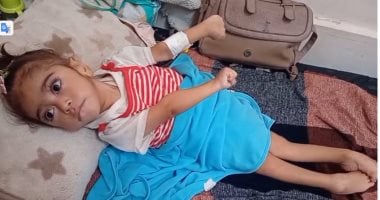 الرضيعة مريم أبو مصطفى ولدت في غزة أثناء الحرب وإعاقة دماغية تهدد حياتها