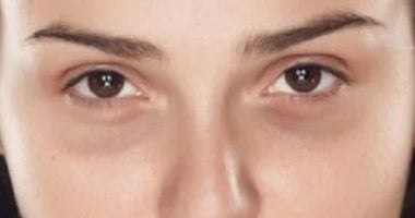 بعد صحيان الصبح للمدرسة.. 4 خطوات تكافح ظهور الهالات السوداء عند الأمهات