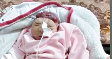بسبب الغازات السامة.. ولادة أطفال بلا رأس فى غزة.. 144 مولودا مشوها.. زيادة الإجهاض لـ300% بعد إسقاط 85 ألف طن متفجرات.. منظمة الصحة العالمية: 60 % من مستشفيات غزة غير قادرة على استقبال حالات الولادة المعقدة