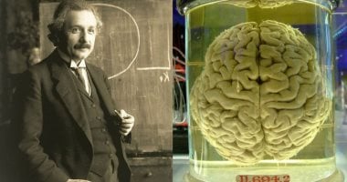 تقنية صينية جديدة قد تفتح الباب لتحليل دماغ أينشتاين المحفوظ