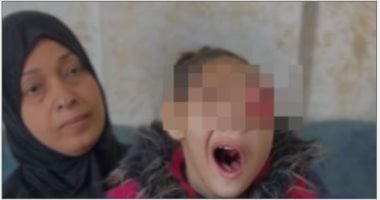رغم سفرها للعلاج خارج غزة.. وفاة الطفلة هناء العوضى بعد نهش السرطان جسدها
