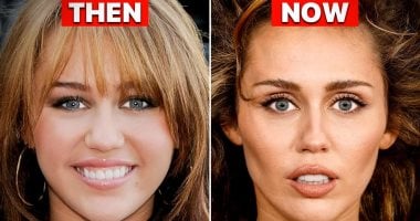 5 نجمات واجهن انتقادات بعد عمليات تجميل غيرت ملامحهن.. آخرهن مايلى سايرس