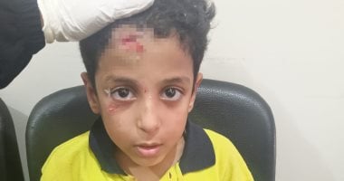 إصابة طالب بجرح قطعى داخل مدرسة فى أكتوبر وولى الأمر يطالب بمحاسبة المقصرين