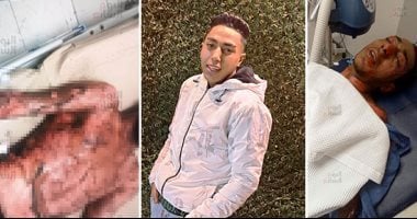 مات البطل.. عبد الله ضرب مثالا للفداء فى إنقاذ مسنة من الموت.. اقتحم النيران بعد محاصرتها لسكان عقار فيصل ووصل بالسيدة إلى بر الأمان.. احترق جسده وودع الدنيا بعد 11 يوما من الألم.. صور