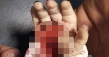 الطب الشرعى يفجر مفاجأة فى مصرع رضيعة بسوهاج بسبب عرسة