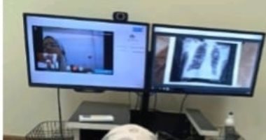 الصحة: توزيع 2152 مولد أكسجين على مرضى التليف الرئوي بنظام العلاج المنزلي