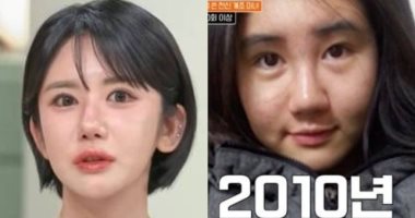 كورية جنوبية تجرى 400 عملية تجميل خلال 15 عاما