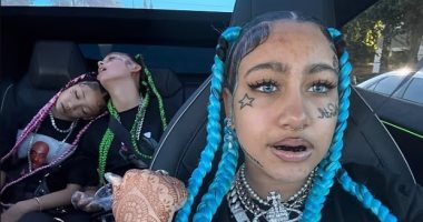 ابنة كيم كارداشيان تثير قلق متابعيها بعد ظهورها بأسنان سوداء.. فيديو وصور