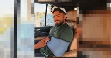 تامر حسنى يكشف سبب خضوعه لعملية جراحية في ذراعه