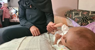 عينه مش بتغمض أبدا ورأسه قد جسمه 4 مرات.. طفل صورته رجفت قلوب الناس