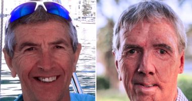 زراعة وجه مطبوع ثلاثى الأبعاد لبريطانى بعد تعرضه لحروق شديدة