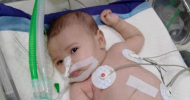 أيسل ماضي.. طفلة من غزة تواجه مرضا نادرا وسط حصار إسرائيلي يمنع عنها العلاج