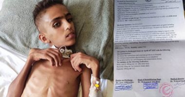 الطفل حلمي بربخ شاهد جديد على مأساة حرب غزة ويحتاج علاجا في الخارج.. صور