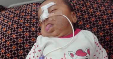 جنة مطير.. رضيعة تحارب السرطان ومتلازمة نادرة وسط انهيار منظومة الصحة بغزة