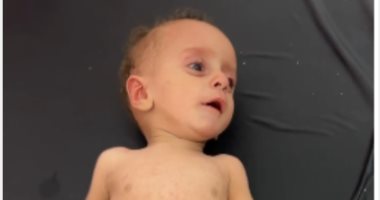 بعد نشر «اليوم السابع» معاناته.. الرضيع الفلسطينى أنس أبو سعيد يسافر للعلاج فى إيطاليا