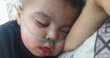 حياة الطفل عز الدين معلقة بالأكسجين والأمل أمام عجز المستشفيات فى غزة