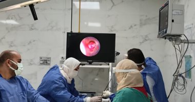 نجاح الفريق الطبى بمستشفى صدر المنصورة فى إجراء منظار تجويف صدرى لشاب 25 عامًا
