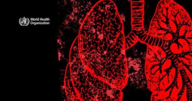 الصحة العالمية: 10.7 مليون بالعالم أصيبوا بالسل مع 1.23 مليون وفاة فى 2024