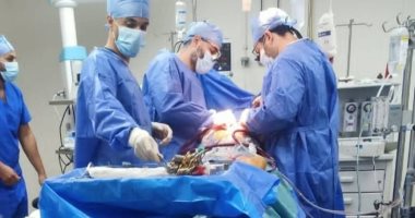 جراحة نادرة لاستئصال ورم بالقلب لسيدة أربعينية فى مستشفى طامية بالفيوم