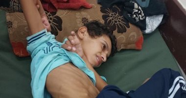 يوسف أبو عمرة طفل فلسطينى مصاب بشظايا الصواريخ يواجه الموت فى غزة.. صور