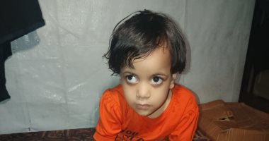 سيلا النجار طفلة تولد مرتين تحت النار.. صراع مع المرض ونقص الدواء فى غزة