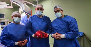 مستشفى بنى سويف للتأمين الصحى ينجح فى استئصال ورم سرطانى بفخذ مريض مسن