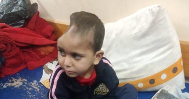 يزن الطفل الذى خرج وحيدا من تحت الركام.. ناج بلا عائلة بجمجمة مبتورة نتيجة استهداف إسرائيلى يصارع الموت بين جدران مستشفى فى غزة..  وصرخة عمته الأخيرة تطالب بإنقاذ حياته: لا يوجد أحد يرعاه غيرى.. صور