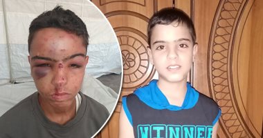 صرخة استغاثة من غزة.. نوبات الصرع والتشنجات تهدد حياة الطفل عبد الله عصفور