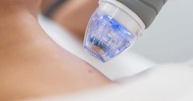 ابتكار رقعة قابلة للتحلل تساعد على الشفاء من آثار النوبات القلبية