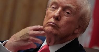 ترامب يظهر بضمادة على معصمه أثناء توقيع اتفاقية سلام فى أفريقيا.. اعرف التفاصيل