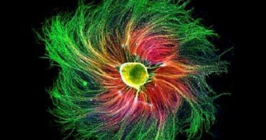 أغرب 7 جوائز فى العالم اللفت أبرزها.. سمعت عنها قبل كده؟