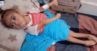 بعد نشر قصة معاناتهم.. أطفال غزة يسافرون رومانيا وإيطاليا للعلاج