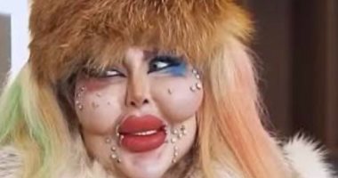 إنفلونسر تثير الجدل بعد 388 عملية تجميل وتصرح: الجوهر أهم من الشكل.. صور