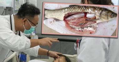 صينية تدخل العناية المركزة بعد تناول وصفات شعبية لتخفيف الصداع