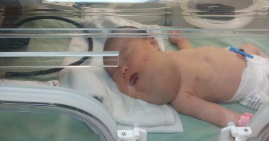 أنفاس معلقة بالحضانة.. حكاية حور العين قشطة وصراع رضيعة مع الموت فى قطاع غزة