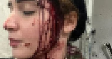 المجني عليها